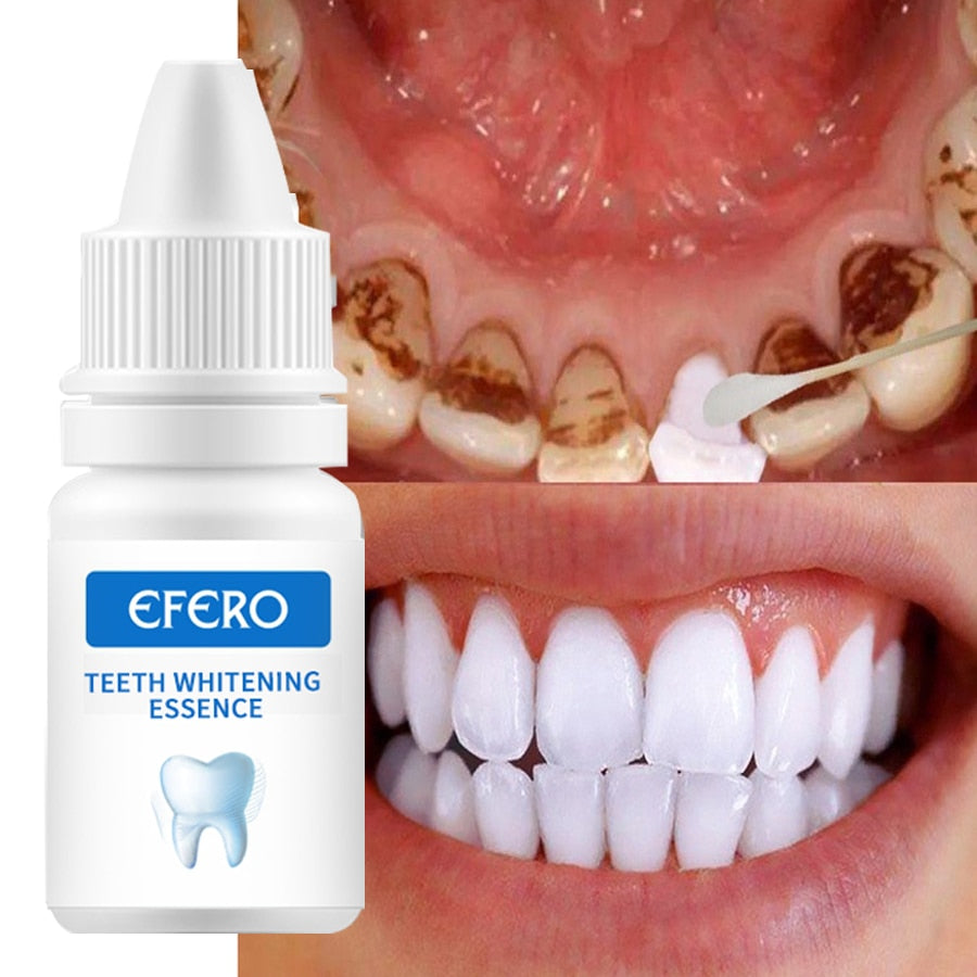 EFERO Essence de blanchiment des dents