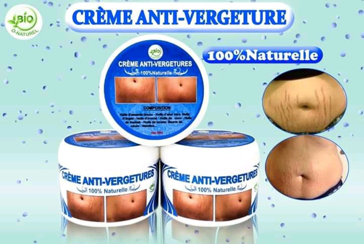 crème anti vergeture